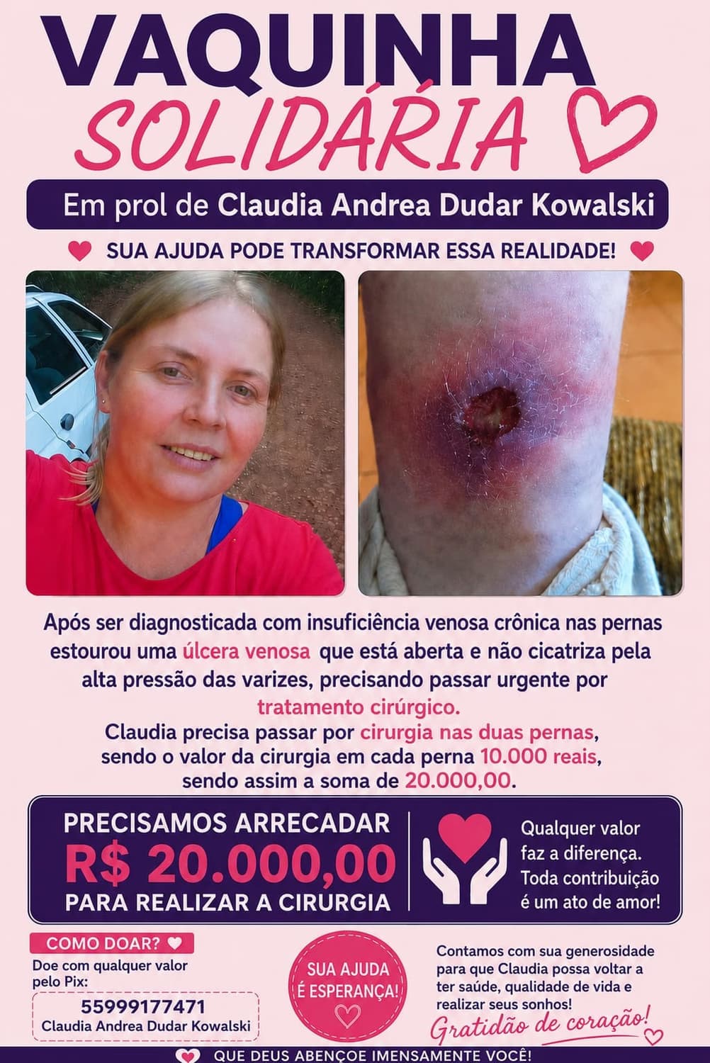 Moradora de Santo Augusto precisa de ajuda urgente para cirurgia nas pernas