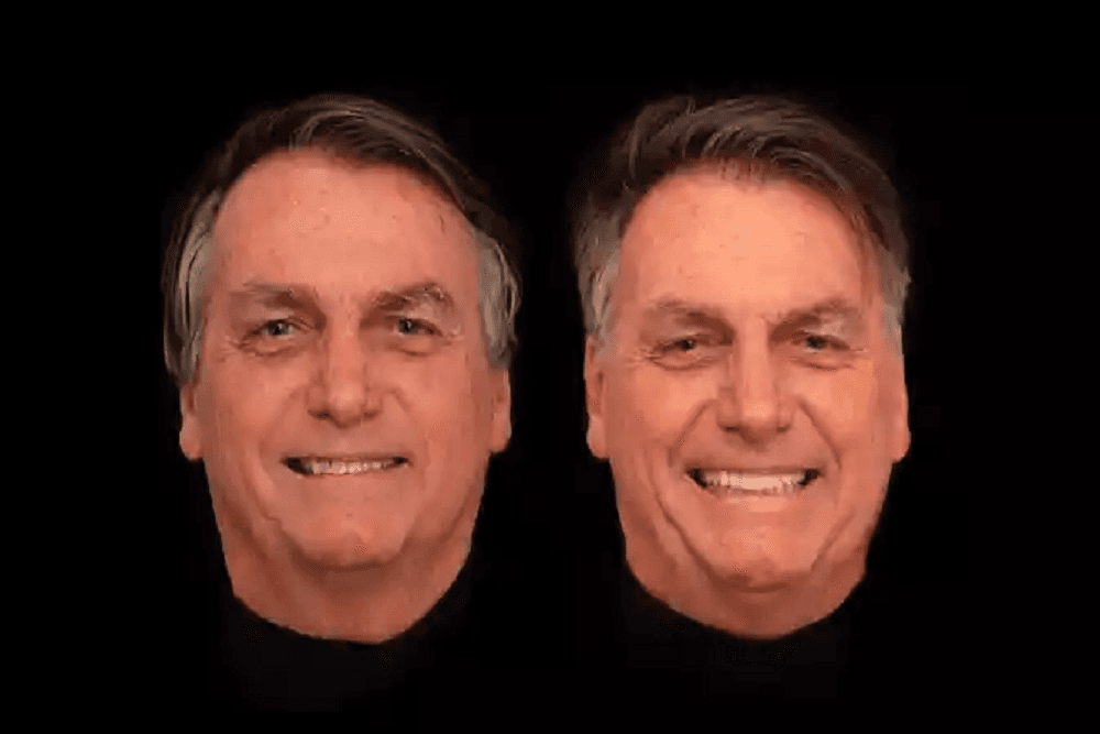 Bolsonaro realiza harmonização facial e dentária no valor de R$ 84 mil