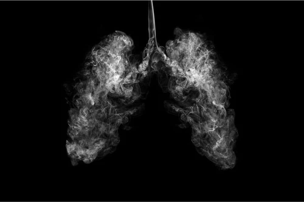 Hospital Bom Pastor registra 41 óbitos por câncer em 2025 e número acende alerta para prevenção