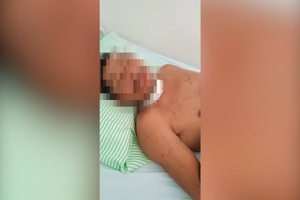 Indígena é enterrado vivo e escapa de cova rasa em MS: ‘Falaram que eu tinha morrido’