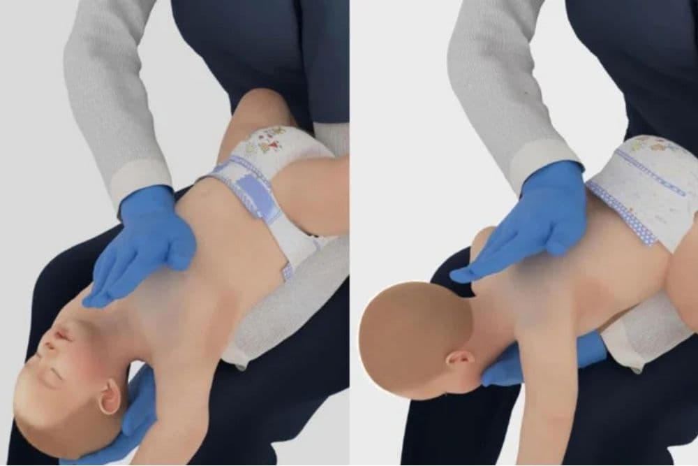 Manobras para desengasgo de bebês e adultos são atualizadas; veja passo a passo