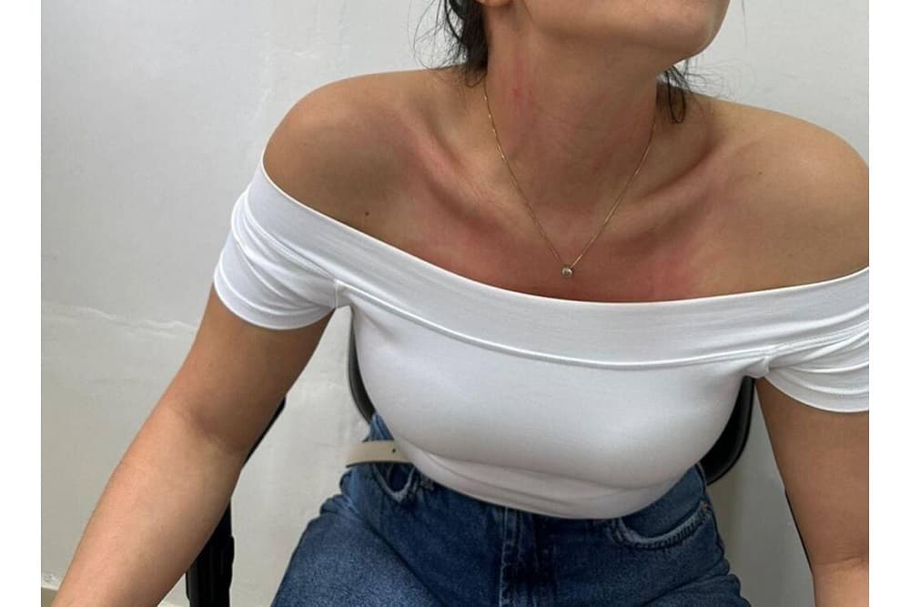 Secretária de Saúde é agredida dentro da UBS de Barra Funda