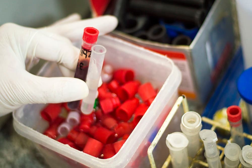 Prazo para renovação do exame toxicológico de CNHs com validade entre julho e dezembro de 2022 termina na quinta-feira