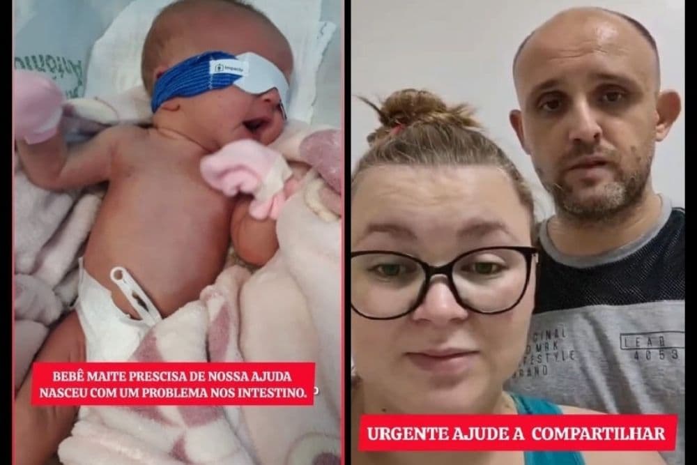 Família de recém-nascida de Humaitá busca vaga para cirurgia de urgência