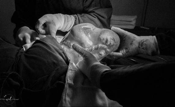 Fotógrafa faz foto e vídeo de nascimento de bebê empelicado em SC; registro é considerado raro