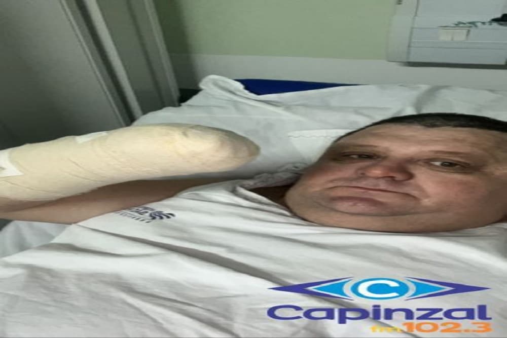 Humorista Pilha perde a mão esquerda em acidente com foguete em SC