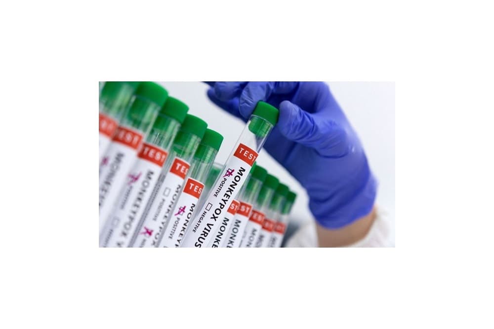 Secretaria Estadual da Saúde confirma primeiro caso da varíola do macaco no Rio Grande do Sul