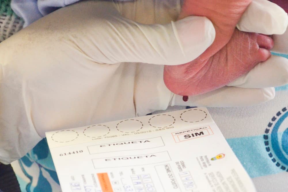 Diagnóstico da toxoplasmose congênita é incluído no Teste do Pezinho