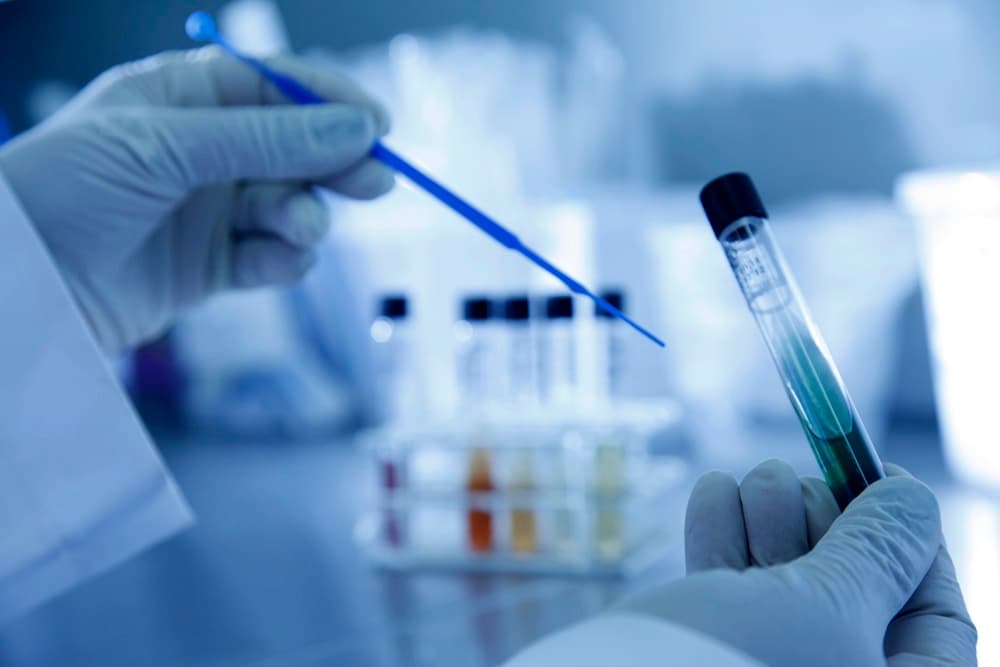 Governo Federal prorroga prazo para realização de exame toxicológico