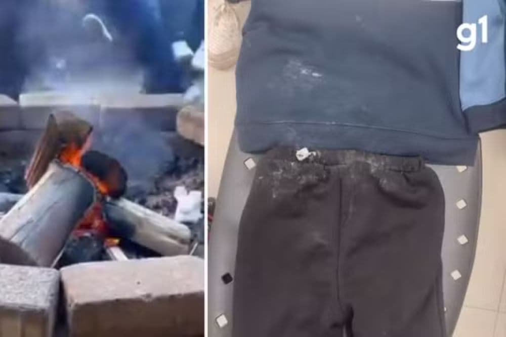 Criança de 3 anos sofre queimaduras de 2º grau após cair em fogueira em escola no RS