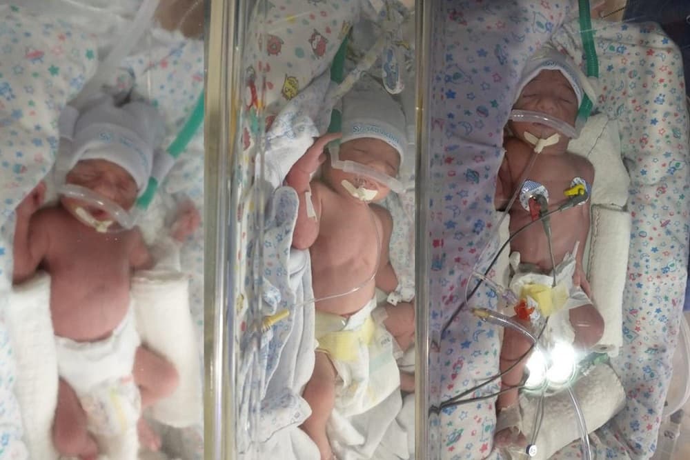 Asher, Ayla e Ayme: conheça os trigêmeos de Coronel Bicaco